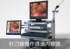 成都强直性脊柱炎医院