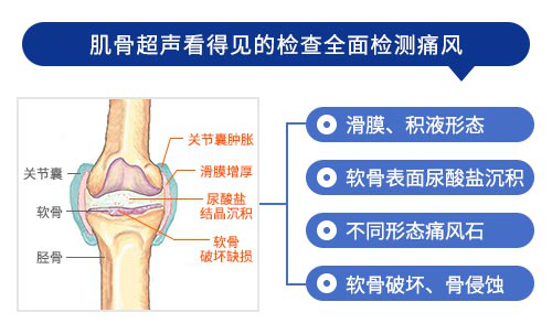 成都肌骨超声