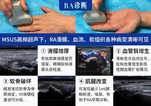 成都肌骨超声